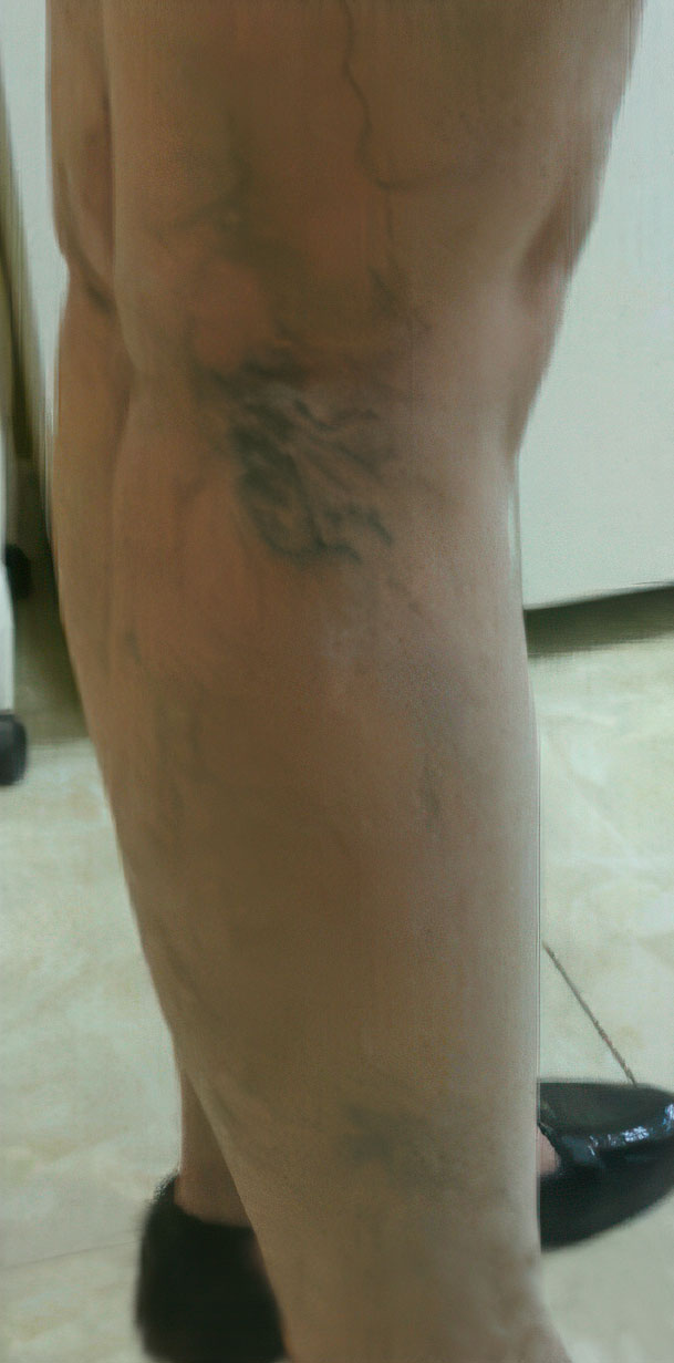 Before
